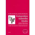 Endoprotéza kolenního kloubu -- Průvodce obdobím operace, rehabilitací a dalším životem. Pavel Vavřík, Antonín Sosna – Hledejceny.cz