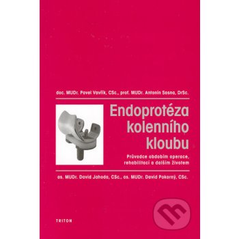 Endoprotéza kolenního kloubu -- Průvodce obdobím operace, rehabilitací a dalším životem. Pavel Vavřík, Antonín Sosna