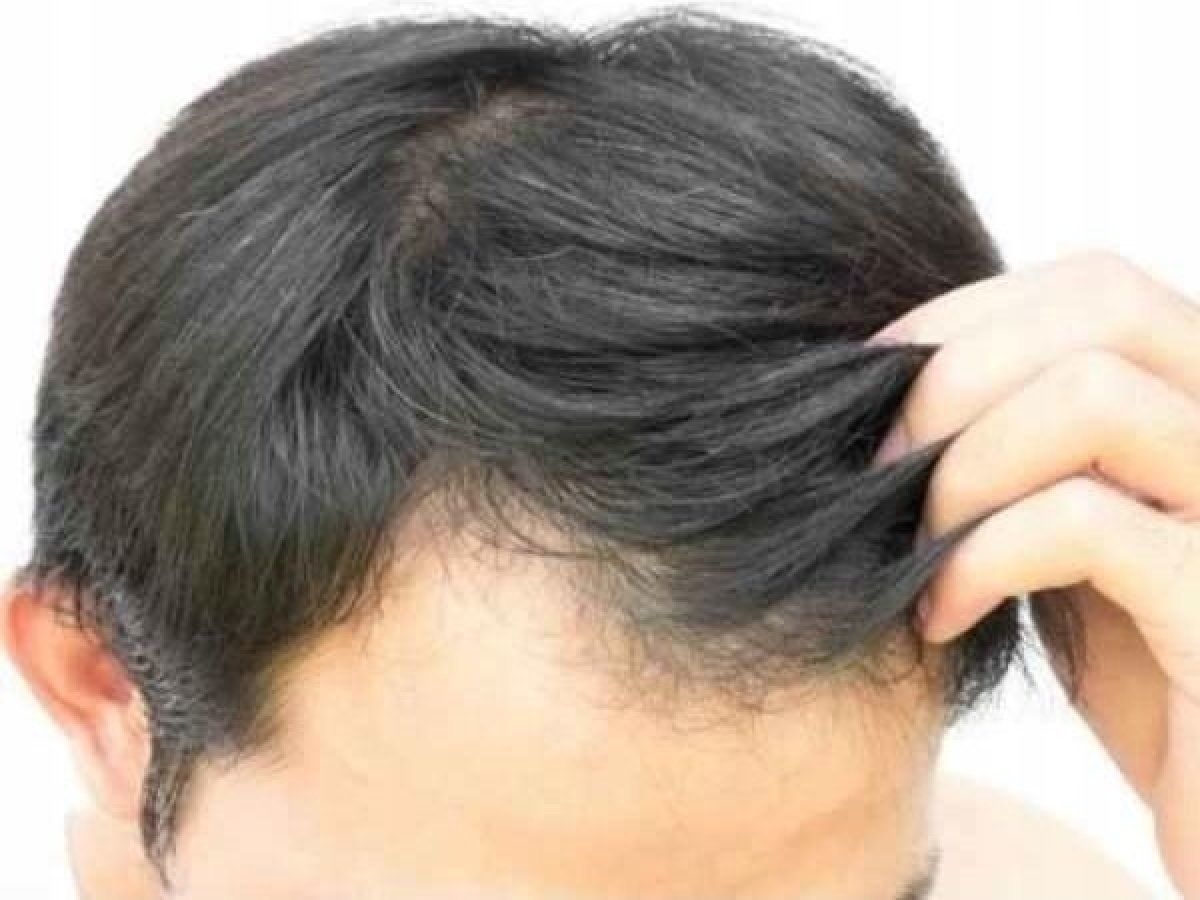 Síla kofeinu pro vaše vlasy