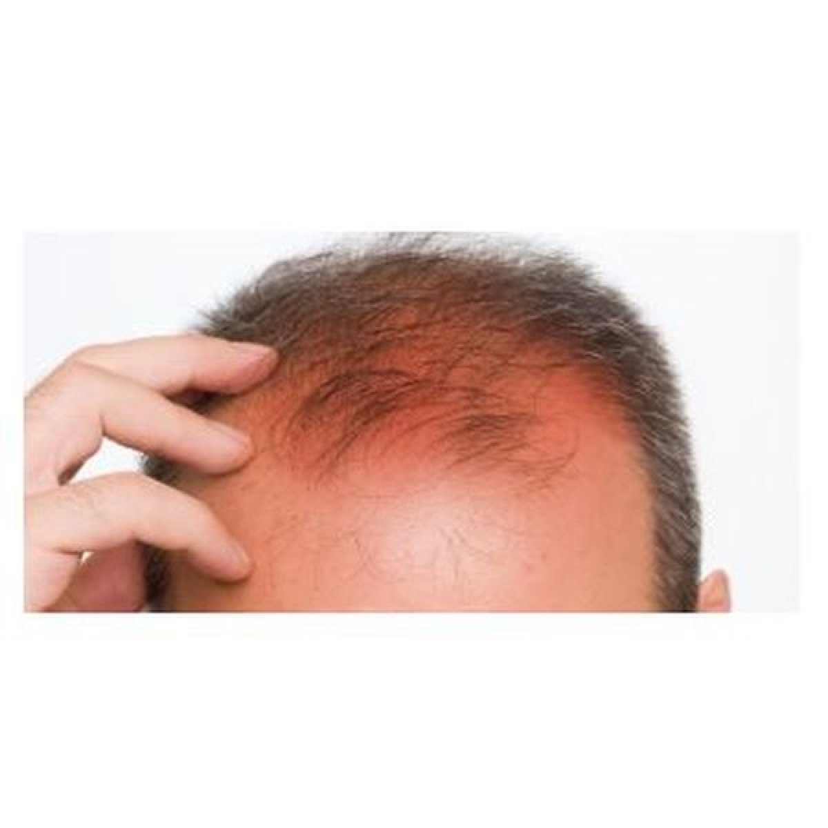 Zastavte vypadávání