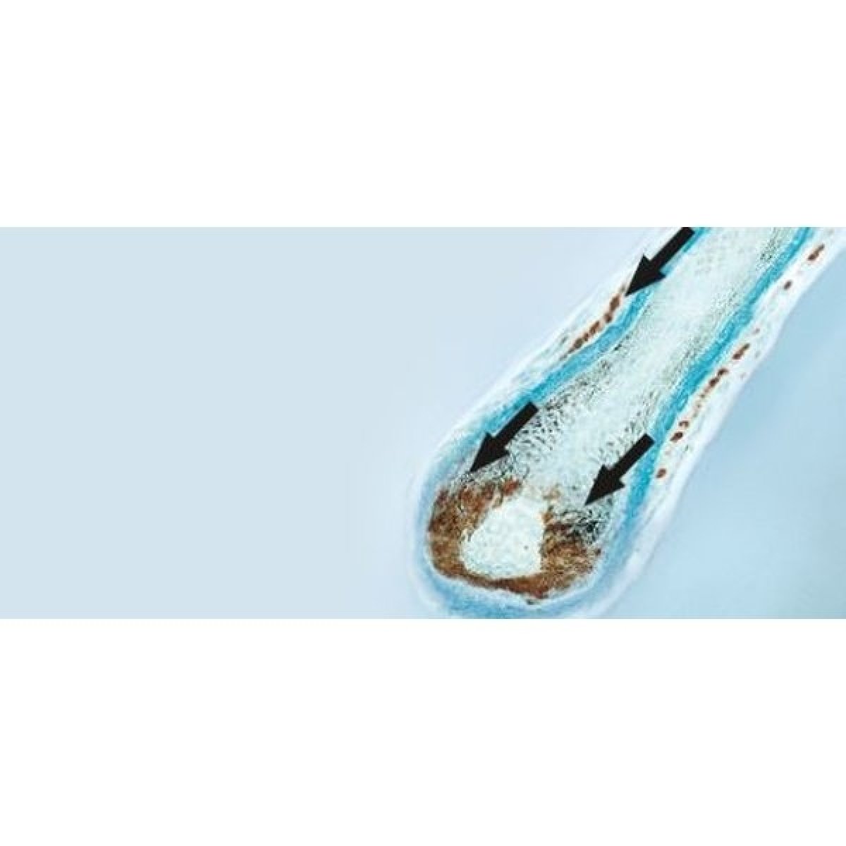 Maximální výživa od kořínků