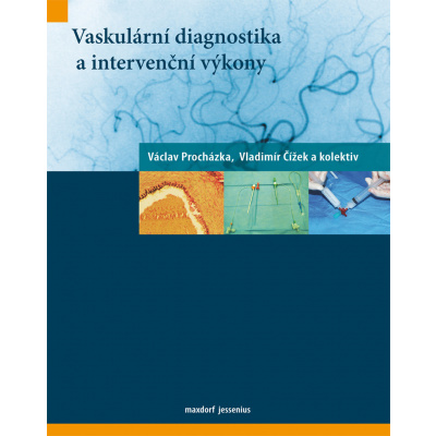 Vaskulární diagnostika a intervenční výkony - Vladimír Čížek, Václav Procházka