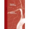 Diseases of the Aorta - František Sabol, Adrian Kolesár, Panagiotis Artemiou