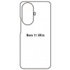 engaroGuard Hydrogel - zadná ochranná fólia - Huawei Nova 11 Ultra priesvitná