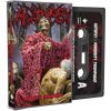 Autopsy - Morbidity Triumphant (MC kazeta)