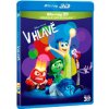 V hlavě 2BD (3D+2D)