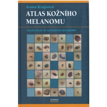 Atlas kožního melanomu - Ivana Krajsová