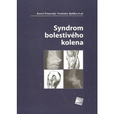 Syndrom bolestivého kolena - Karel Trnavský, Vratislav Rybka a kol.