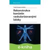 E-kniha Rekonstrukce končetin vaskularizovanými laloky - Tomáš Kempný