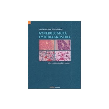 Gynekologická cytodiagnostika - Jaroslav Horáček, Jitka Kobilková