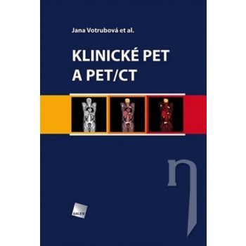 Klinické PET a PET/CT - Jana Votrubová