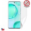 Screenshield Anti-Bacteria HUAWEI Honor 50 fólie na displej HUA-HON50AB-D