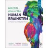 MRI/DTI Atlas of the Human Brainstem in Transverse and Sagittal Planes (George Paxinos,Teri Furlong,Ken Ashwell,Evan Calabrese,G. Allan Johnson)(Pevná)