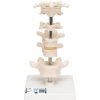 Model šiestich ľudských stavcov na podstavci (Anatomické modely)