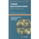 Syndrom polycystických ovarií - David Cibula, Luboslav Stárka, Jana Vrbíková