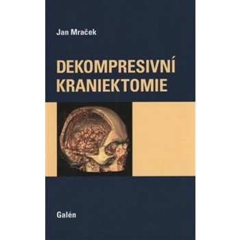 Dekompresní kraniektomie