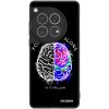 Picasee ULTIMATE CASE pro OnePlus 12 5G - Brain - White