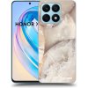 Picasee ULTIMATE CASE pro Honor X8a - Cream marble