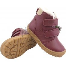 Protetika Zimná detská obuv Tedy Bordo
