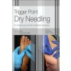 Trigger Point Dry Needling