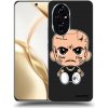 Picasee silikónový čierny obal pre Honor 200 Pro 5G - Separ