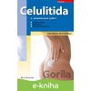 E-kniha Celulitida - Alice Schmidtová, Erika Hübelová