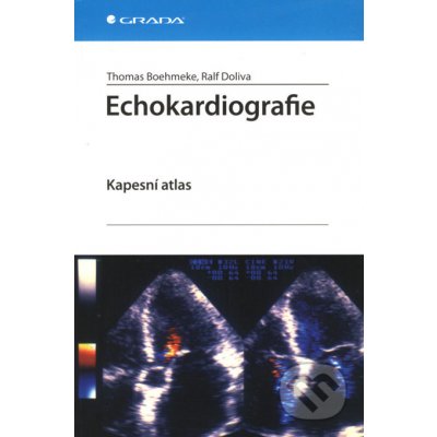 Echokardiografie - Thomas Boehmeke, Ralf Doliva