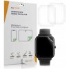 3x Ochranná fólia na display kwmobile Huami Amazfit GTS 2 Mini průhledná