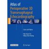 Atlas of Perioperative 3D Transesophageal Echocardiography