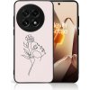 VSETKONAMOBIL 109459 MY ART Ochranný kryt pre OnePlus 13 5G ROSE GIRL (198)