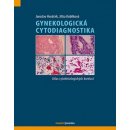 Gynekologická cytodiagnostika - Jaroslav Horáček, Jitka Kobilková