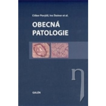 Obecná patologie - Ctibor Povýšil, Ivo Šteiner