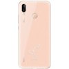 iSaprio číre puzdro – Škorpión – Huawei P20 Lite SIMstir-TPU2-P20lite