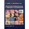 Praktická dermatologie v obrazech a schématech - 1. vyd.