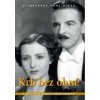 Krb bez ohně - DVD