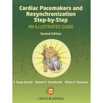 Cardiac Pacemakers and Resynchronization Step by Step Barold S. Serge