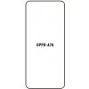 engaroGuard Hydrogel - ochranná fólia - OPPO A78 4G priesvitná nepoužívam kryt = fólia na celý displej 1 kus s výrezom prednej kamery