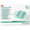3M TEGADERM Film 1624W 6 cm x 7 cm 100 ks