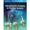 Illustrated Tips and Tricks for Intraoperative Imaging in Fracture Surgery (Michael J. Gardner)(Pevná)
