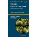 Syndrom polycystických ovarií - David Cibula, Luboslav Stárka, Jana Vrbíková