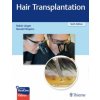 Hair Transplantation (Robin Unger,Ronald Shapiro)(Pevná)