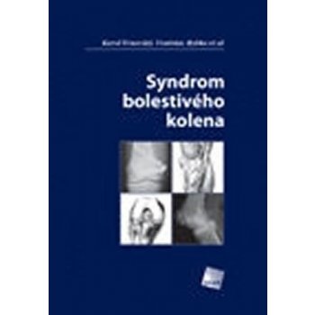 Syndrom bolestivého kolena - Karel Trnavský, Vratislav Rybka a kol.