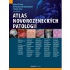 Atlas novorozeneckých patologií - Miloš Černý, Miroslava Balaščaková, Tomáš Fait