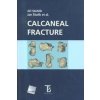 Calcaneal fracture - Jiří Stehlík, Jan Štulík