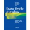 Reverse Shoulder Arthroplasty