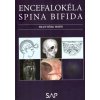 Encefalokéla spina bifida - František Horn
