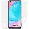 Ochranná fólia Screenshield ALIGATOR FiGi Note 3 Pre fólie na celé telo (ALG-FGNT3PR-B)