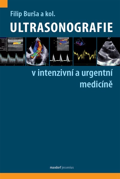 Ultrasonografie v intenzivní péči