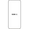 engaroGuard Hydrogel - ochranná fólia - Xiaomi Redmi 12 5G priesvitná nepoužívam kryt = fólia na celý displej 1 kus s výrezom prednej kamery