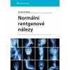 Normální rentgenové nálezy - Torsten B. Möller